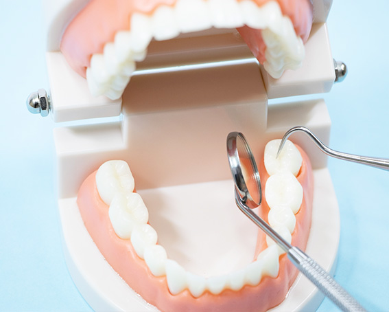 歯のクリーニング