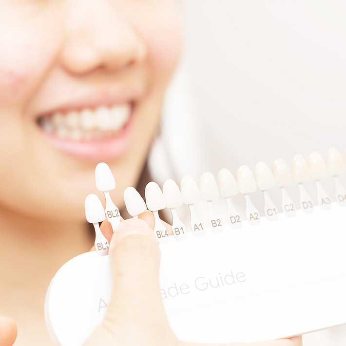 審美と予防を両立する総合的な診療