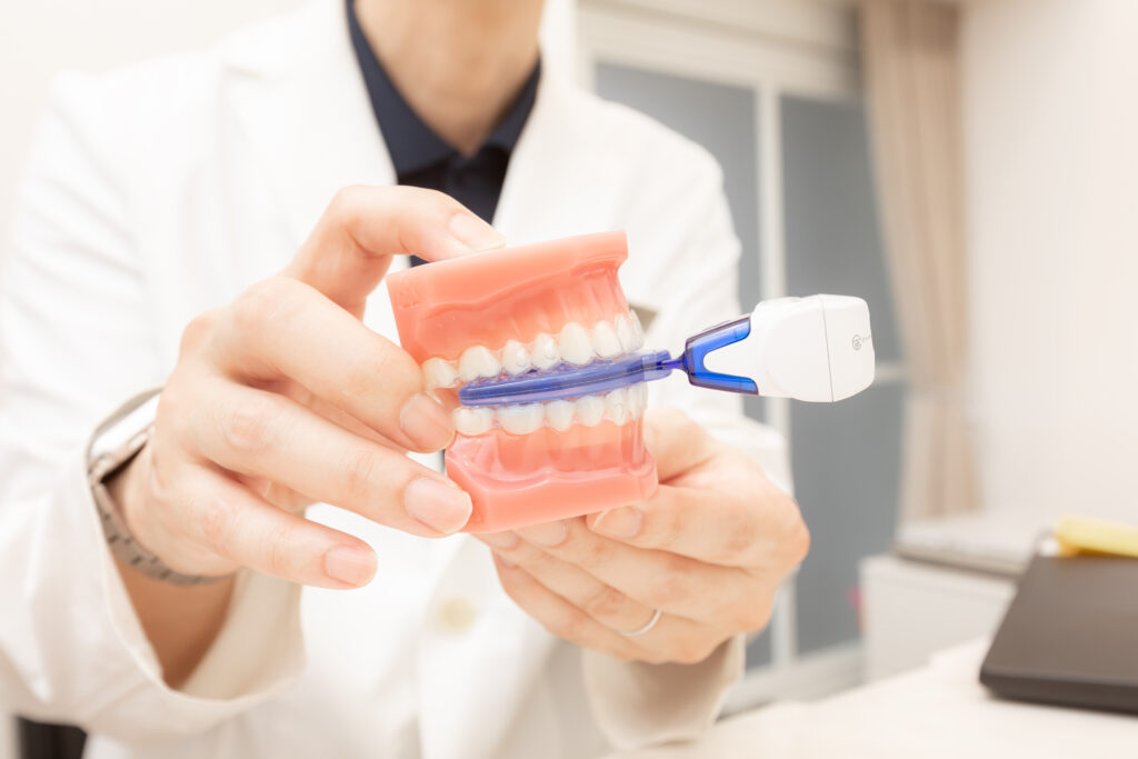 SURESMILE VPRO（加速装置）